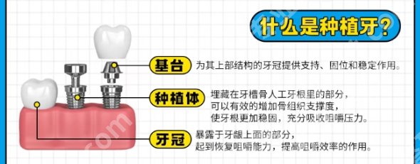 杭州牙齿种植哪个医院好？医院项目范围广实力强！