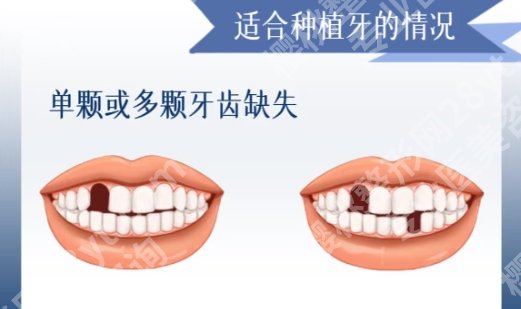 常州牙齿种植医院排名名单！2025全新价格表单附上！