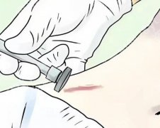 冯少清医生疤痕怎么样？看看医生信息_顾客评价了解