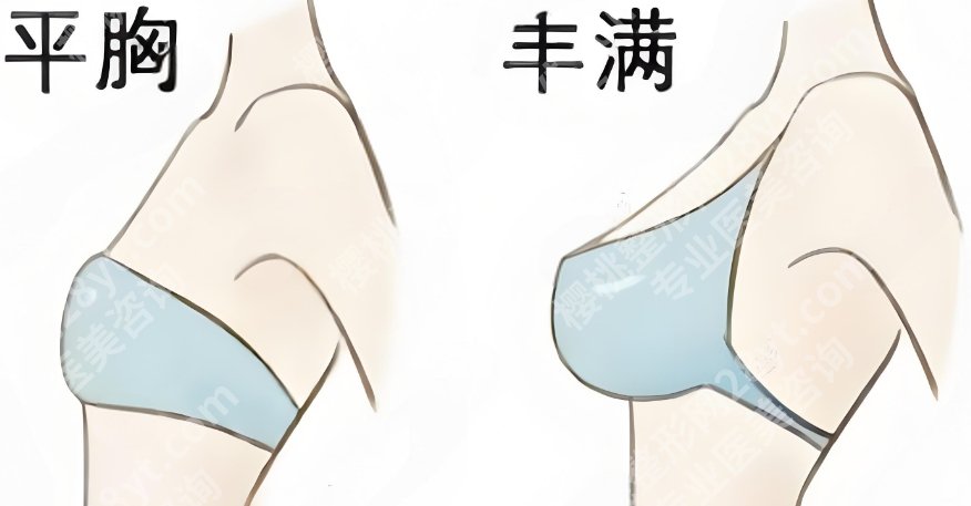深圳廖祥钧隆胸如何？医生技术点评|口碑点评！价格参考表