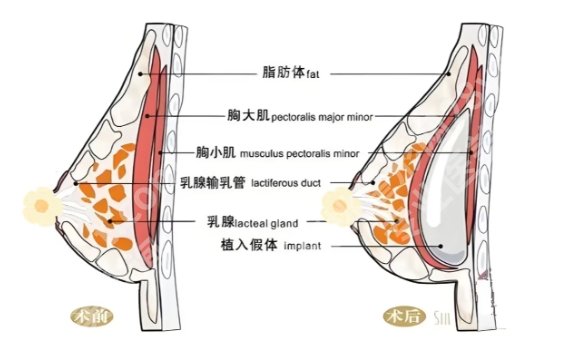 顾建英医生个人资料分享！擅长项目点评|案例鉴赏！