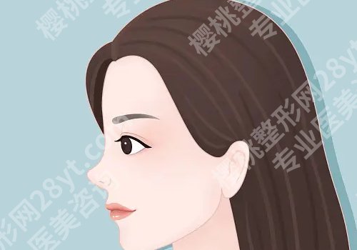 李东医生在院整外科的地位与口碑评价咋样?附隆鼻案例新鲜出炉!
