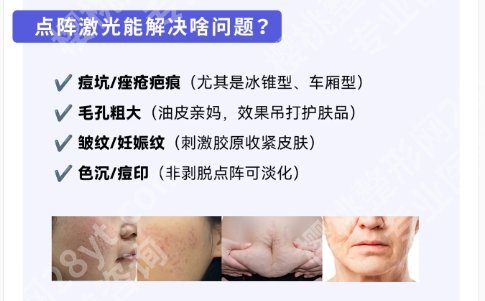 长春吉大二院点阵激光多少钱？医院物美价廉|医生名单揭秘！