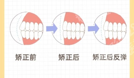 南昌一附院牙齿矫正多少钱？医院项目详情|用户口碑参考！