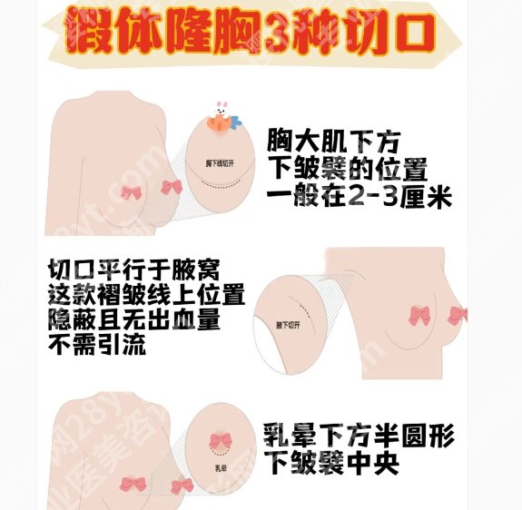 曹玉娇医生擅长什么项目？医生擅长项目曝光！网友反馈参考
