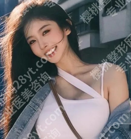 祁敏医生双眼皮案例曝光！坐诊医院及个人资料来袭！