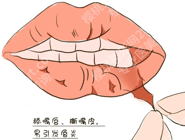 潘柏林医生唇部手术案例分享！医生技术盘点！速速码住
