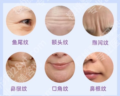 北京潞河医院整形美容价目表一览!项目细节公布!必看