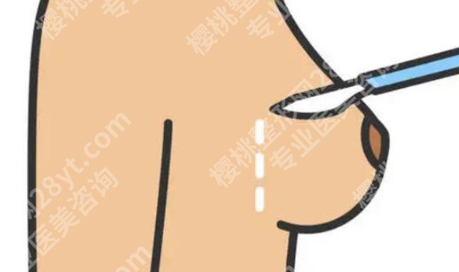 成都李烈医生技术优势怎样？医生技术前沿！评价良好