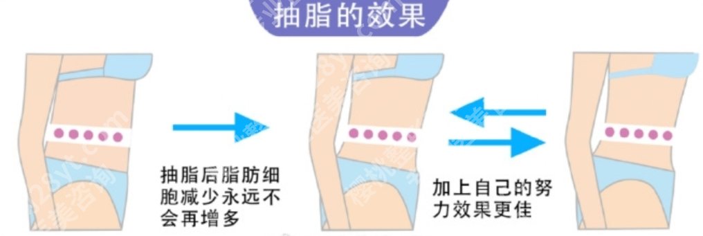 杭州冯志丹吸脂怎么样？医生技术实力派大咖！口碑点评