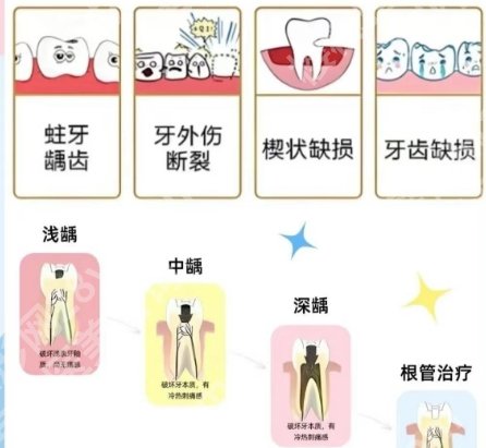 广州中医药大学第一附属医院牙科补牙技术如何？技术优势|口碑测评！