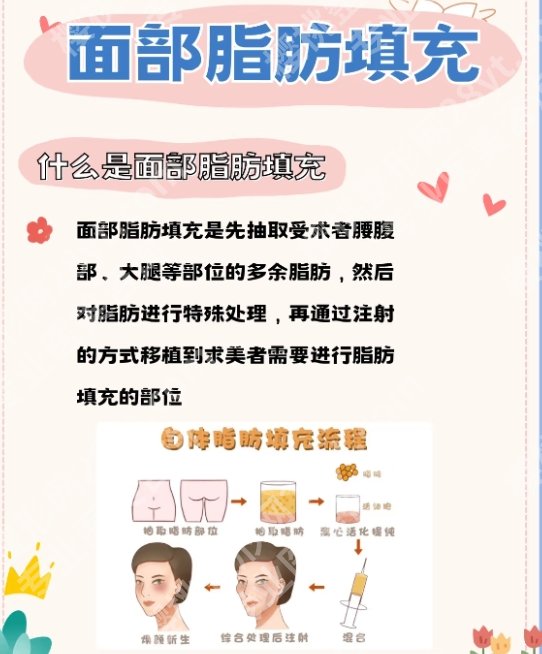 北京八大处面部脂肪填充医生:顾云鹏、陈博、张超技术优势分析!
