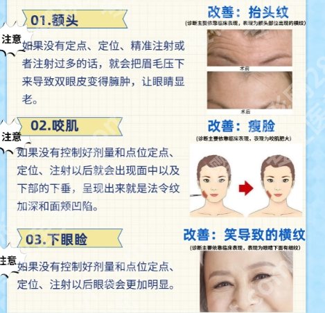 上海长征医院玻尿酸怎么样？真人案例图鉴赏！戳进来看