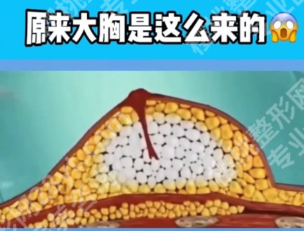 北京协和医院吸脂丰胸技术如何?经典案例展示!