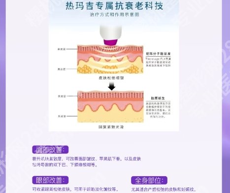 北医三院热玛吉多少钱？医院人气医生介绍！案例分享