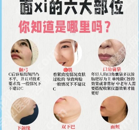 成都刘珍君面吸技术如何？靠谱吗？案例图鉴赏！