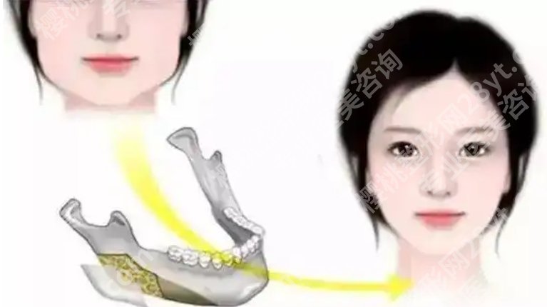山东省立医院磨骨手术价格透明！医院核心项目详情！