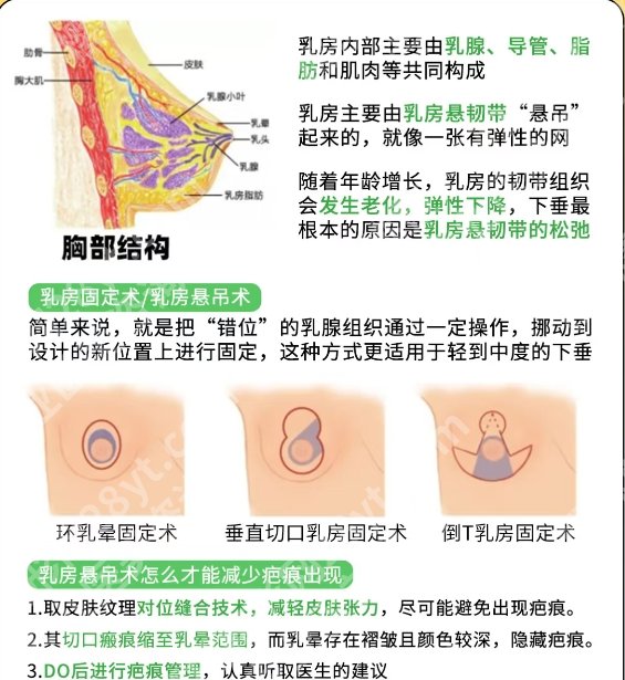 深圳胸下垂矫正医院排名！附术后注意事项！