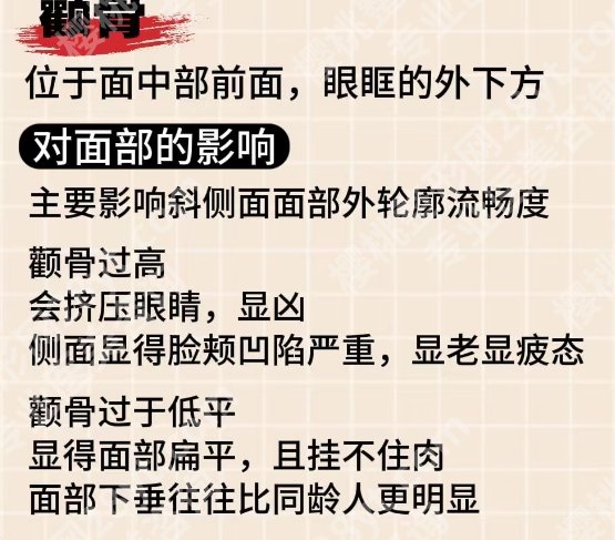 西安颧骨内推有名医生！附项目相关介绍！收藏再看！