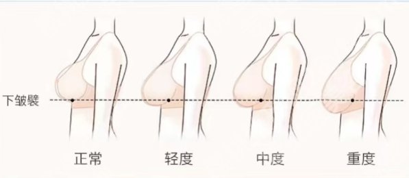 唐志荣医生悬吊技术怎么样？技术优势|坐诊医院介绍！