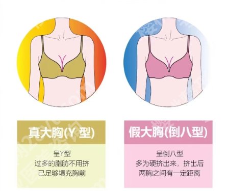 陈育哲医生个人简介来袭！医生实操隆胸案例过程分享！来看效果
