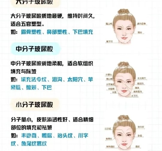 上海时光做初恋脸技术怎么样？贵不贵？医院基本介绍！