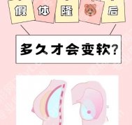 成都西区医院隆胸多少钱？项目明细参考！戳进来看