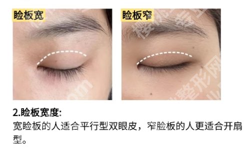 上海长征医院双眼皮价格！医生团队资源|用户口碑！