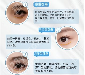 武汉注射卧蚕多少钱？推荐几家性价比不错的医院！