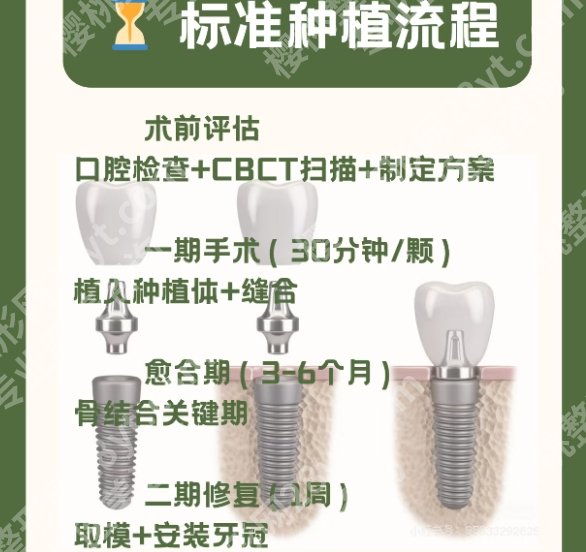 呼和浩特市种植牙哪里好？医院技术实力水平优势！