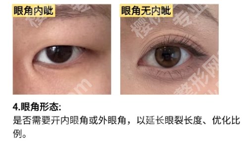 佀同帅擅长哪种双眼皮？医生背景相关介绍！