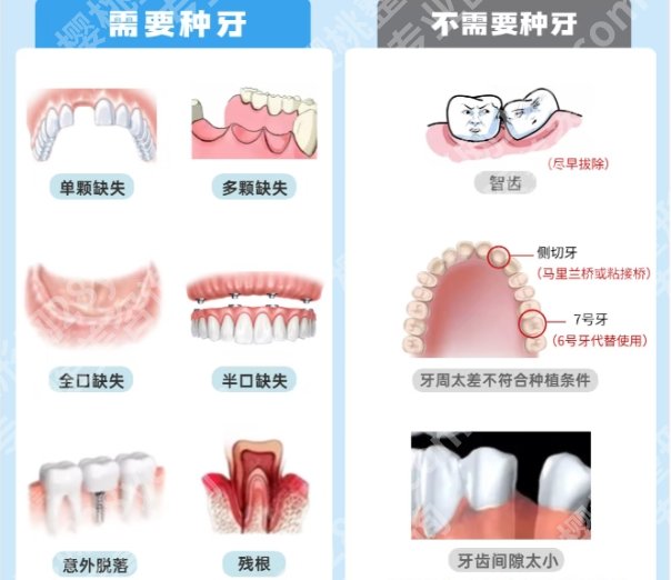 深圳牙科收费价目表一览参考！医院项目技术详情！