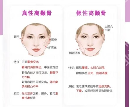 上海时光做颧骨多少钱？2025价格费用明细参考！