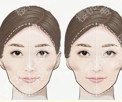 上海时光做颧骨多少钱？2025价格费用明细参考！