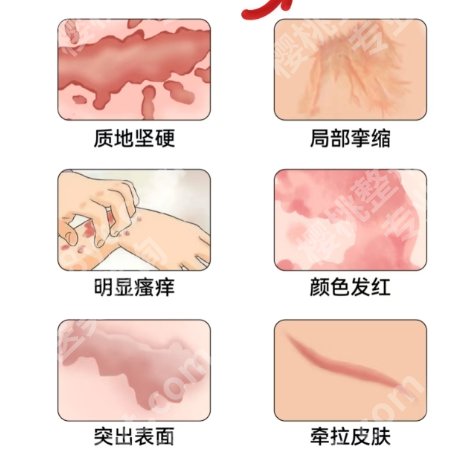 柳州工人医院整形美容价目表汇总！费用清单2025公示