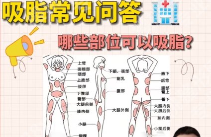 空军总医院抽脂价格贵不贵？2025收费标准更新！速速浏览