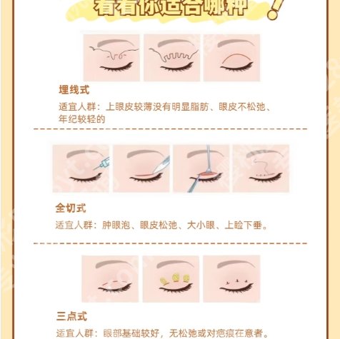 杭州割双眼皮哪里好又便宜？医院开展项目丰富！环境温馨