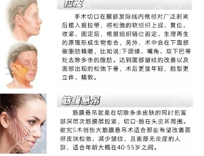 南方医院筋膜悬吊价格是多少？这份变美攻略记得查收！