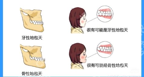 南昌地包天正颌手术医生有哪些？医生技术好经验丰富！
