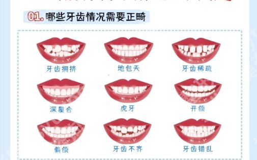 广州正畸医生排名更新啦!医生排名上榜实力介绍！
