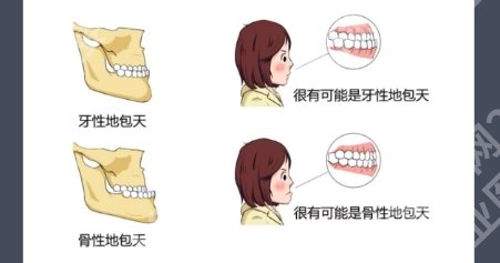 常州地包天矫正医院有哪些？来看看有没有你心仪的医院！