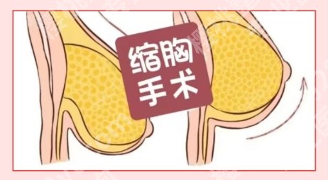 山东省立医院缩胸收费以及医生详细介绍！口碑点评！