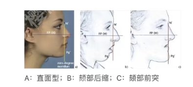 上海九院垫下巴需要排多久？医院简介|口碑点评！