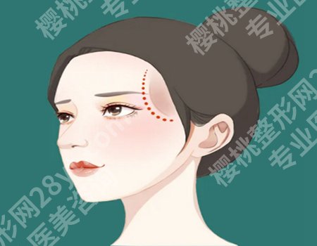 注射伊妍仕后注意事项是什么？伊妍仕项目戳进来看，咨询一一汇总