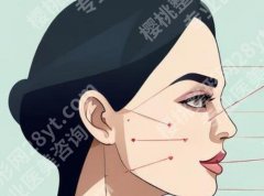 伊婉CP玻尿酸全攻略：适合部位+变美思路+选医指南