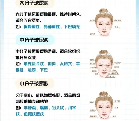 武汉同济医院打玻尿酸多少钱？医院核心项目|价格优势！