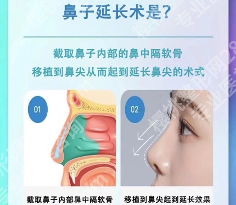 宫风勇做鼻子价格大概多少？医生名声威望技术实力详情！