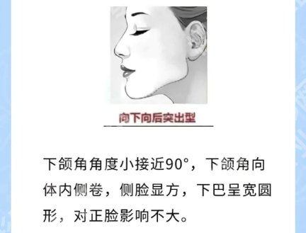 柳超和项昌峰谁厉害？医生擅长项目以及客户口碑！