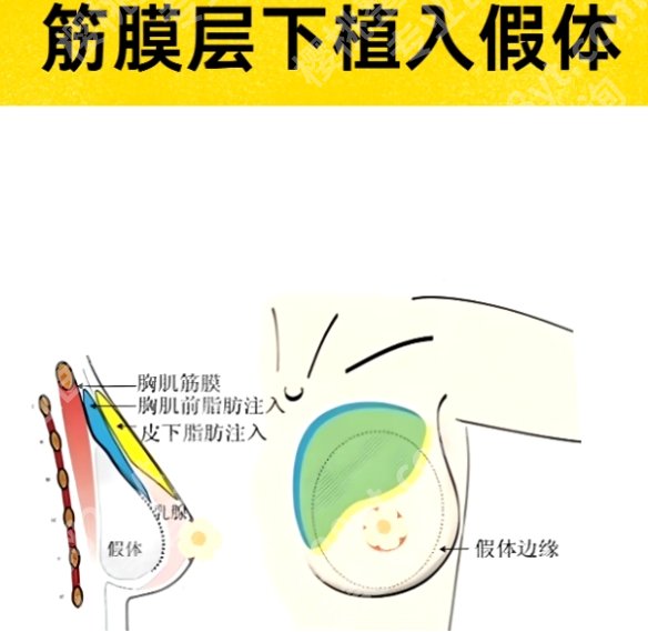 成都美莱熊猛填充技术优势！医生具体信息！附项目疑问解答