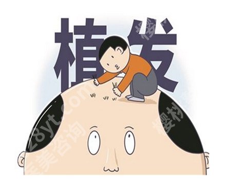 无痕植发多少钱一根？植发各个影响因素一一盘点